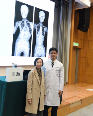 HKUMed research team discovers that genetic factors play a significant role in the development of AIS, paving the way for the future development of new diagnostic methods and potential preventive therapies. (Photo: Professor Jason Cheung Pui-yin and AIS patient Miss Law)
 